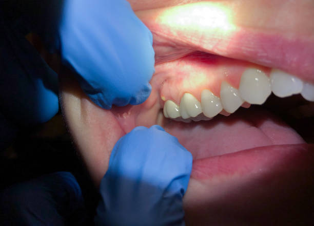 Best Emergency Gum Pain Relief  in Clinton, NC